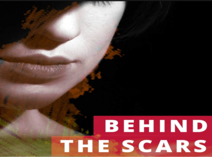 BEHIND THE SCARS